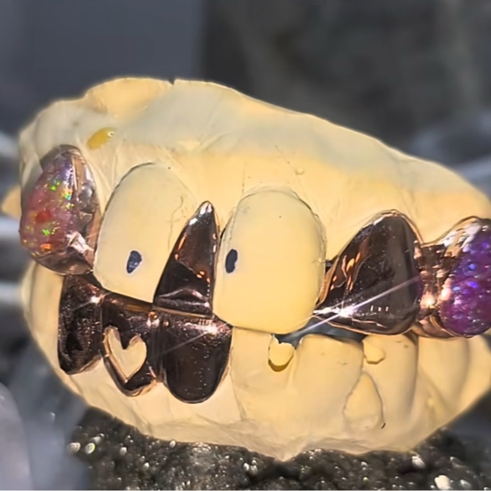 6 Tooth 10k  Custom Grillz
